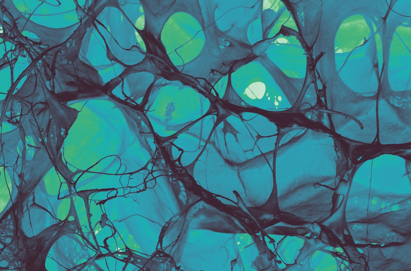 &amp;lt;strong&amp;gt;Tangled Restoration:&amp;lt;/strong&amp;gt; The microstructure of a collagen sponge designed to promote tendon-to-bone healing is captured with SEM and colorized. Because the body often struggles to heal musculoskeletal injuries, we fabricate materials with precise architectures that mimic the original tissue, guiding our cells to recognize and regenerate what was lost. Image: &amp;lt;strong&amp;gt;Kyle Timmer&amp;lt;/strong&amp;gt;, Harley Lab