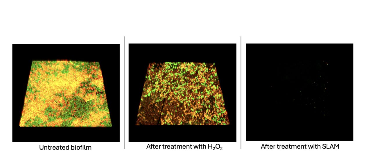 3D renderings of biofilms during different stages of treatment