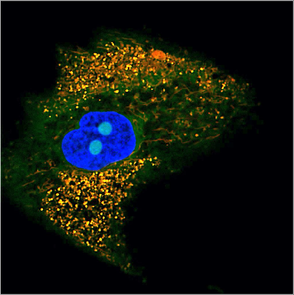 An image of aged cells enriched with oxidative stress, marked in green. The yellow color marks the mitochondria with high oxidative stress.