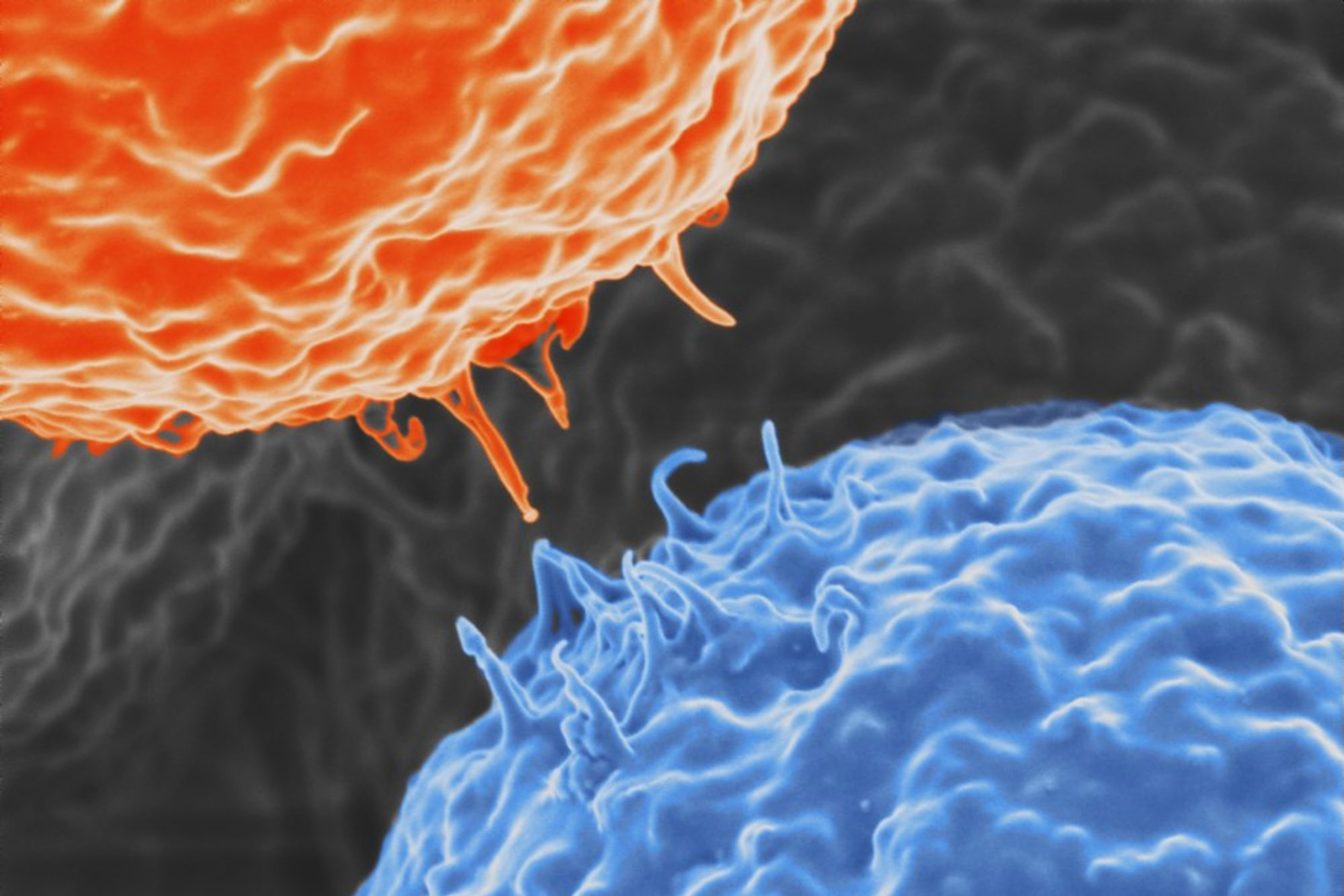 micrograph of electrons resembling planets
