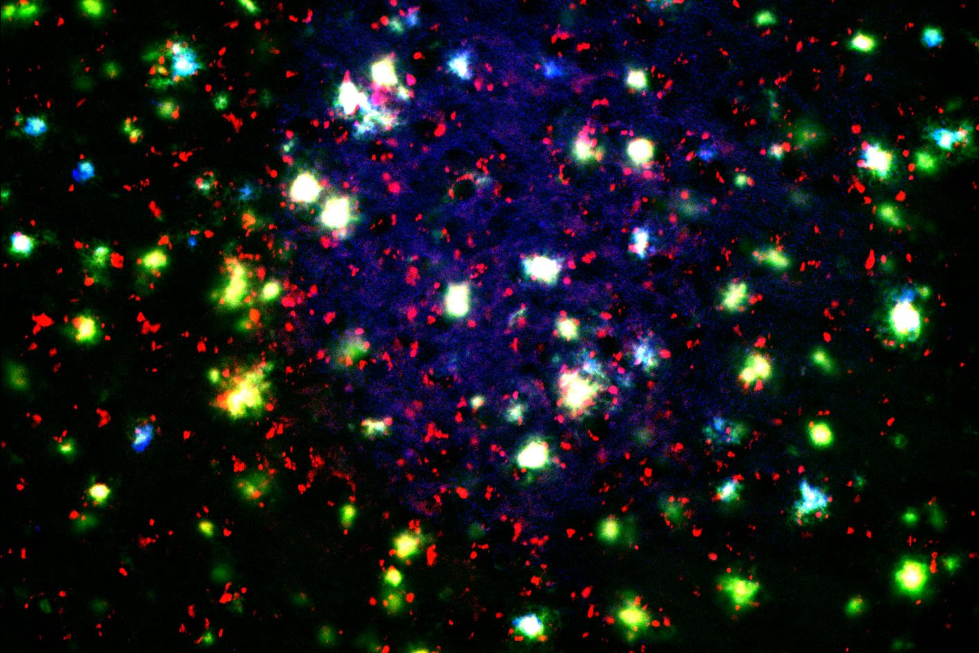 image of brain plaque resembling a starry sky