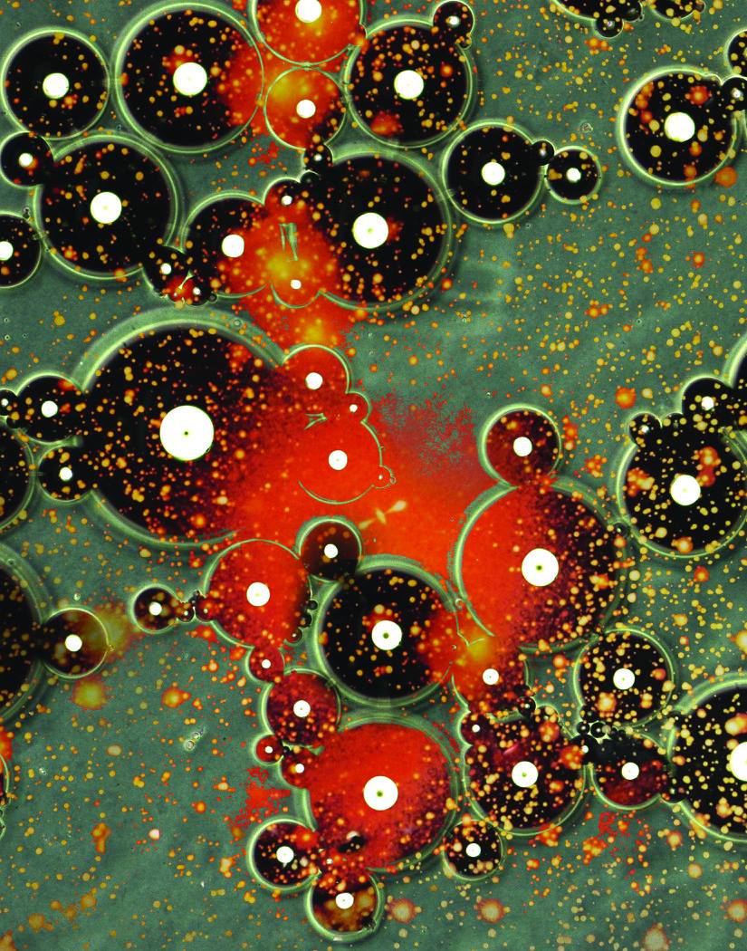 MUSICAL FAMILY Ultrasound imaging is used extensively in diagnostic medicine. When tiny, stable bubbles like the ones shown here  are introduced to the bloodstream as a contrast agent, the difference between blood vessels and the surrounding tissue in echogenicity (the ability to reï¬‚ect the ultrasound waves) is enhanced. The resulting image quality leads to improved diagnosis of cancers and vascular diseases. Zeiss Stereolumar v12 microscope, Jinrong Chen, Hyunjoon Kong Laboratory 6.0 Exhibition,  Funded by the NIH.
