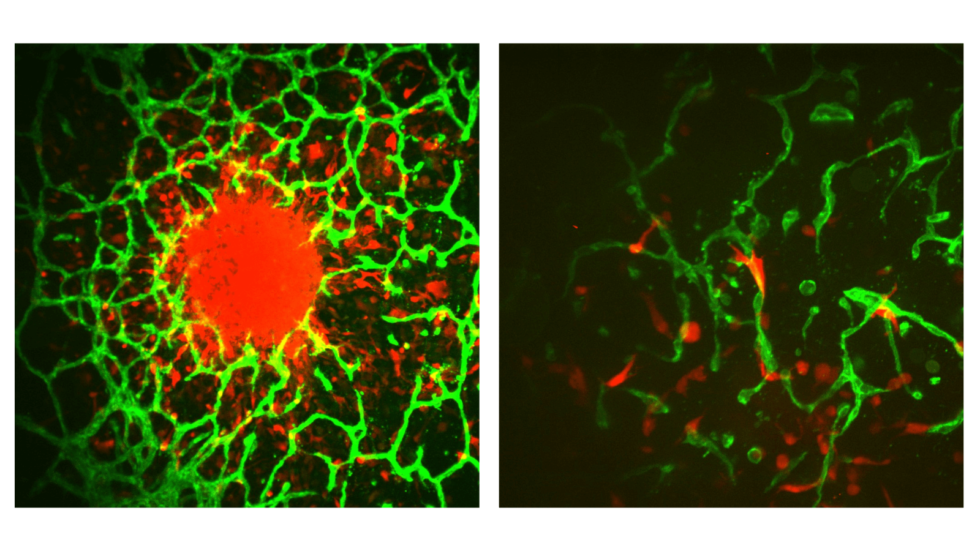 Left &#8211; Individual cells invade away from a central tumor spheroid and into the surrounding vascularized microenvironment. Tumor cells are shown in red and vasculature is shown in green. Right&#160;&#8211; Individual tumor cells (red) interact closely with surrounding vasculature (green). Cell photos provided by Mai Ngo.&#160;
