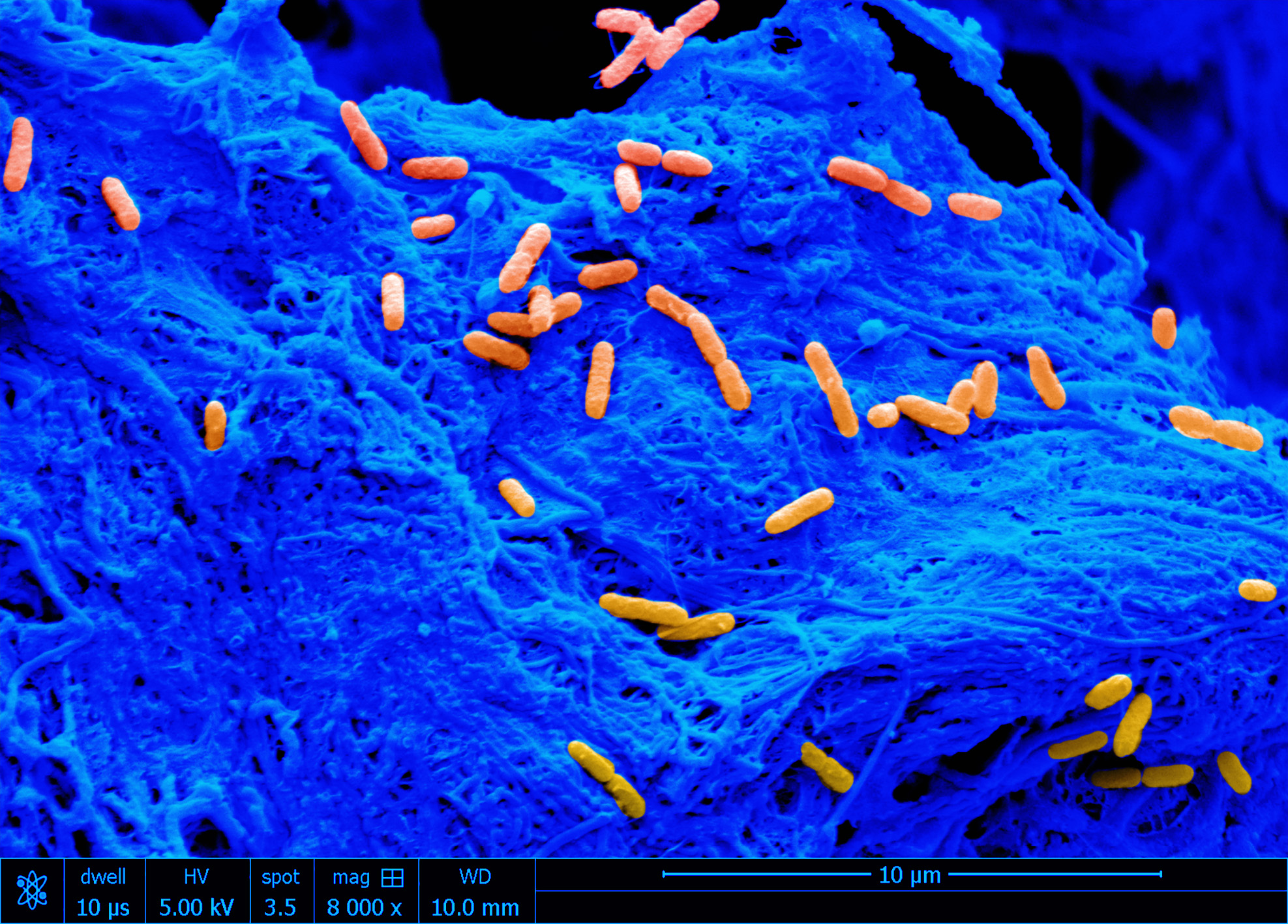 Individual&lt;em&gt;&amp;nbsp;Pseudomonas&amp;nbsp;aeruginosa&lt;/em&gt;&amp;nbsp;cells (orange) on the surface of the collagen scaffold (blue).