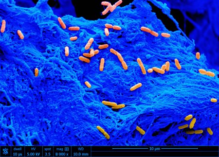 Individual<em>&nbsp;Pseudomonas&nbsp;aeruginosa</em>&nbsp;cells (orange) on the surface of the collagen scaffold (blue).