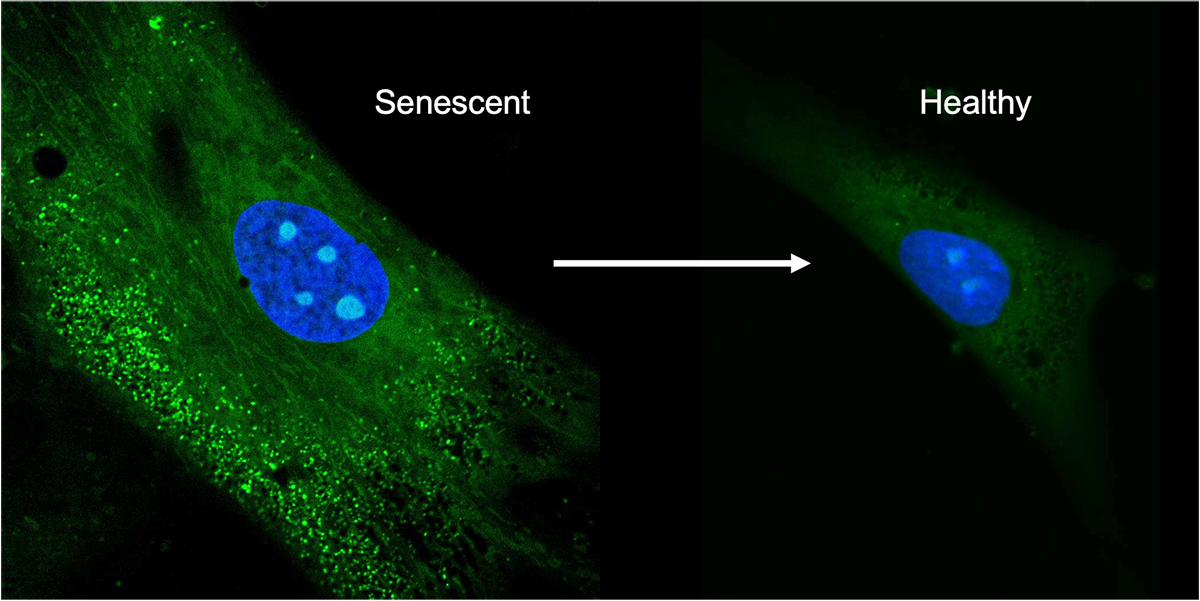 Confocal images of mesenchymal stem cells. The left shows the senescent cells producing unwanted biomolecules, the right shows the cells after treatment with the antioxidant crystals. Photo courtesy Kong Lab.