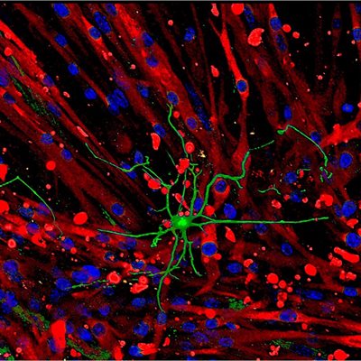 tissue model showing effects of nerve stimulation